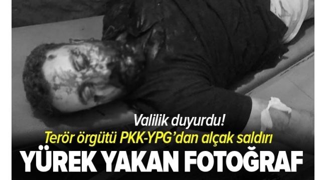 SON DAKİKA HABERİ: Hatay Valiliği duyurdu! YPG/PKK'dan Afrin'de hastaneye alçak saldırı! 18 sivil hayatını kaybetti 